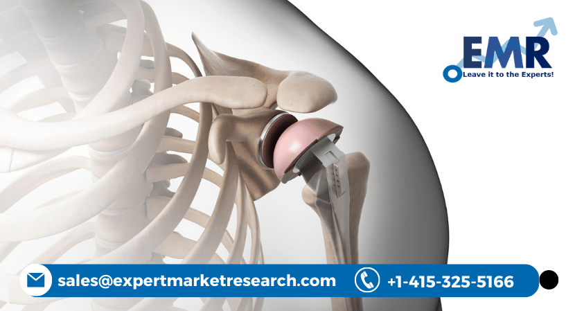 Shoulder Replacement Market Forecast Period Of 2021-2026
