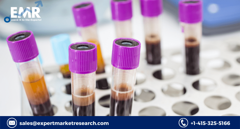 Blood Collection Market Share, Price, Growth, Scope, Report and Forecast Period Of 2022-2027