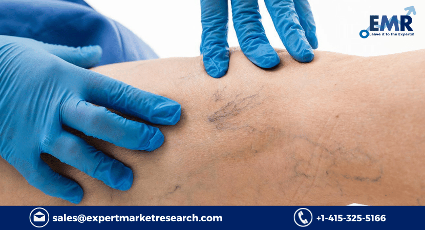 Global Peripheral Artery Disease Market Size, Share, Price