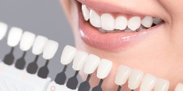 How Cosmetic Dentistry Resolves Common Dental Imperfections